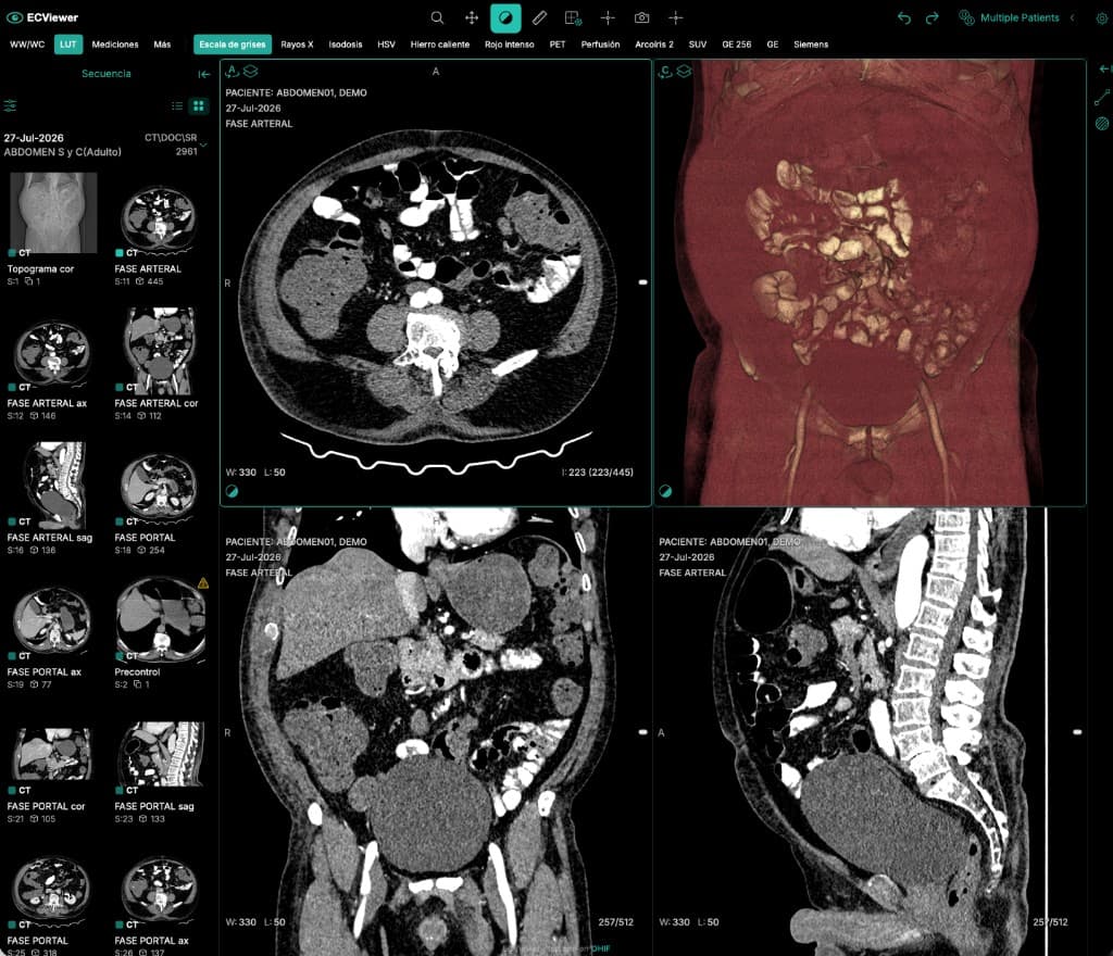 ECRIS — ECViewer